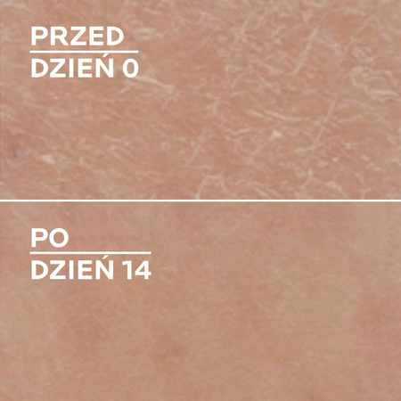 La Roche-Posay Lipikar Lait Urea 10% Nawilżające mleczko do ciała z 10% mocznikiem 400 ml